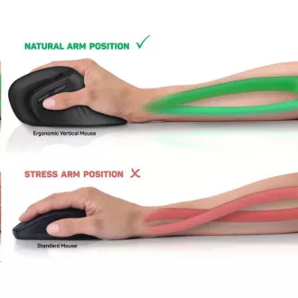 CSATLAKOZTASSA AZ EGÉSZSÉGÉRT ergonómikus függőleges egér (+ 1x AA elem nélkül) vezeték nélküli, fekete CSATLAKOZTASSA AZ EGÉSZSÉGÉRT ergonómikus függőleges egér (+ 1x AA elem nélkül) vezeték nélküli, fekete