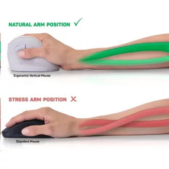 CSATLAKOZTASSA AZ EGÉSZSÉGÉRT ergonómikus függőleges egér, (+ 1x AA elem nélkül), vezeték nélküli, piros CSATLAKOZTASSA AZ EGÉSZSÉGÉRT ergonómikus függőleges egér, (+ 1x AA elem nélkül), vezeték nélküli, piros
