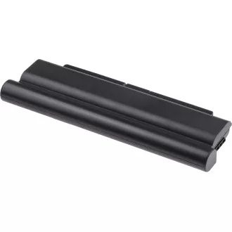 Akkumulátor T6 Power Lenovo ThinkPad T440p, T540p, W540, L440, L540 sorozat, 7800mAh, 87Wh, 9 cellás