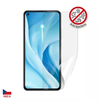 Screenshield Anti-Bacteria XIAOMI 11 Lite 5G NE képernyőfólia XIAOMI 11 Lite 5G NE képernyőfólia